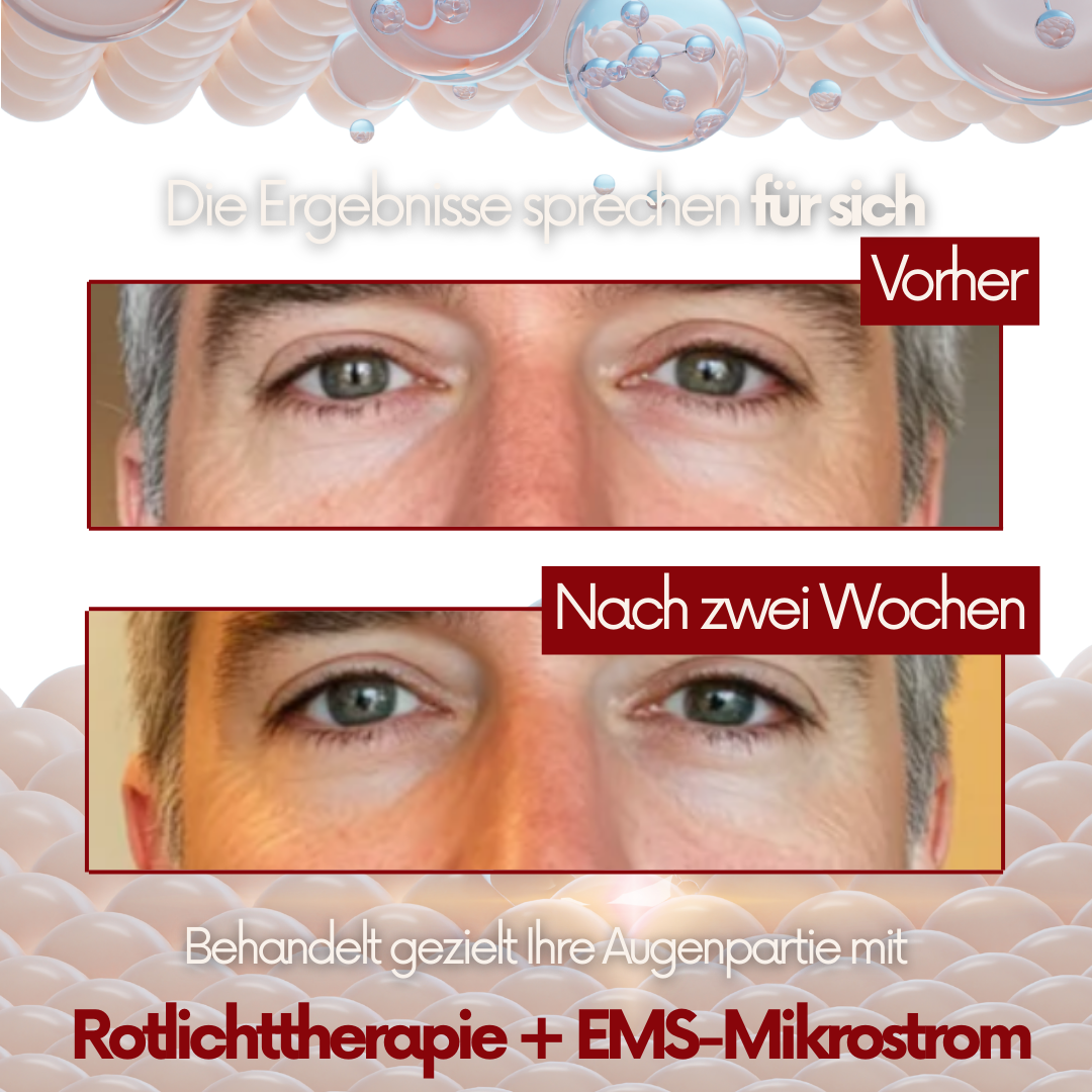 Depura | Rote-Licht-Therapie unter den Augen